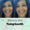 1000 BUTIR PENAMBAL GIGI SUPER KUAT ANTI LUBANG TEMPTOOTH - Gambar 3